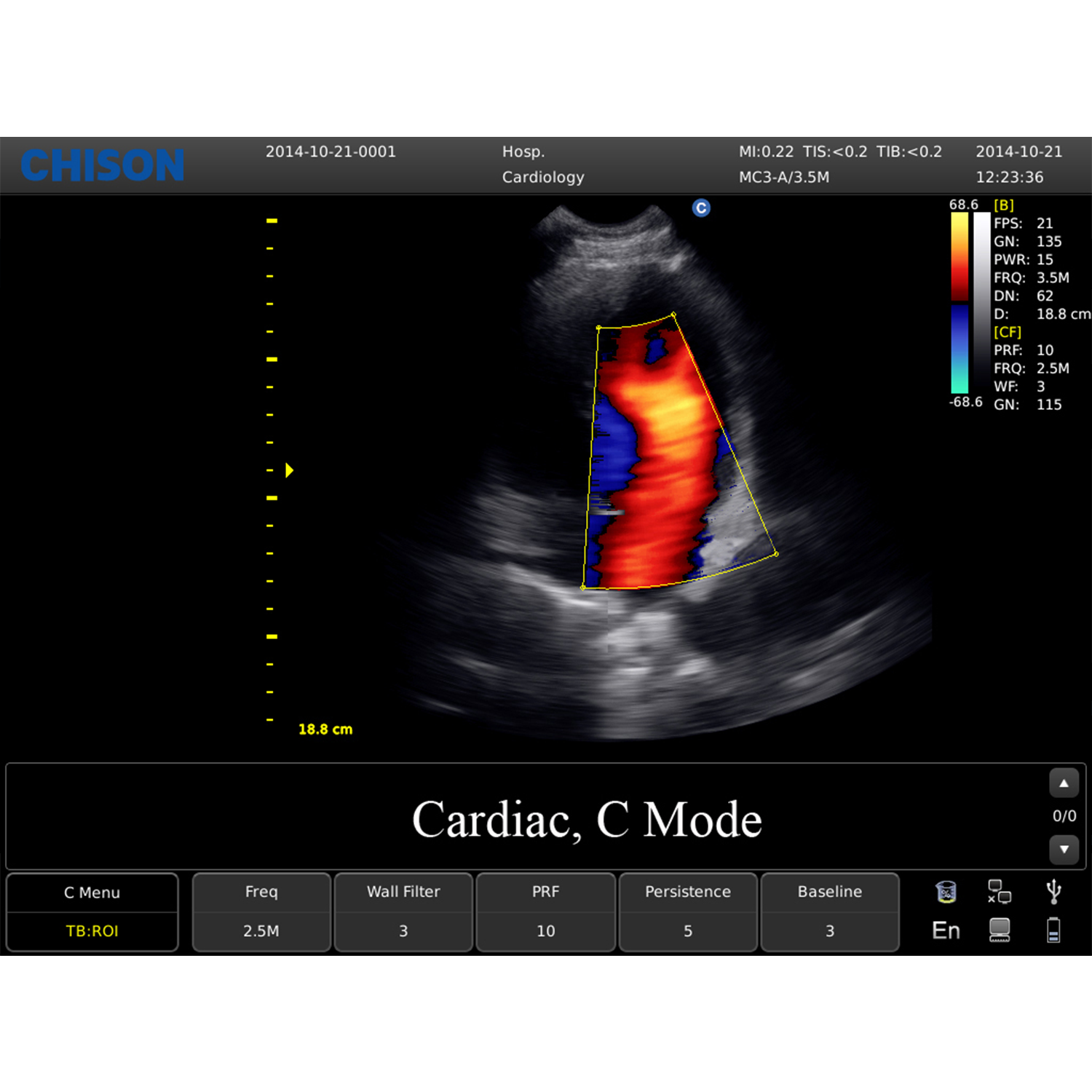 ECO 6 cardiaco CMode